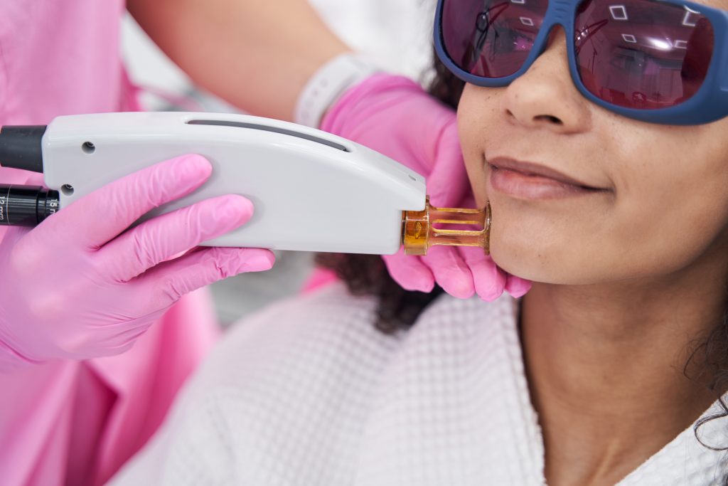 laser frakcyjny nieablacyjny w klinice medycyny estetycznej Roseti Med&Beauty w Myślenicach